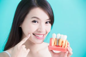 dental implant beyond the seas expectation cost campbelltown