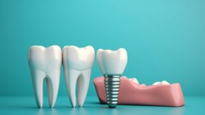 Dental Implants Price Malaysia procedure