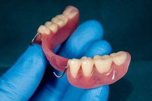 Dental Implants Vs Dentures partial