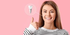 Singapore Dental Implant Cost illustration