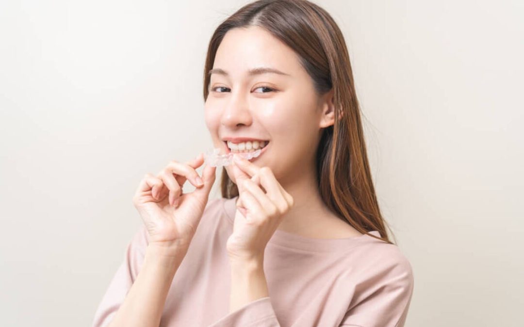 How Much Does Invisalign Cost