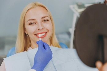 Teeth Whitening on Veneers consult