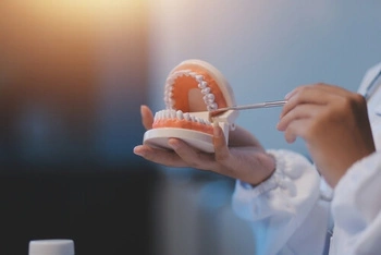 My New Dentures Are Killing Me set