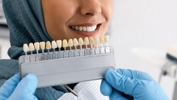 Veneers for Overbite planning