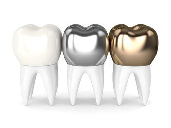 symptoms of loose dental implant crown types